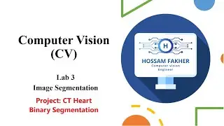 Project: CT Heart Binary Segmentation