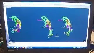 How my New Prosthetic Finger Works