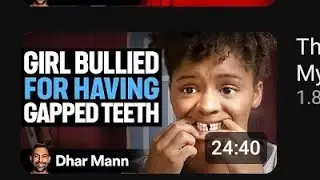 Girl get bullied for Gapped Teeth Dhar Mann