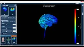Time to exhaustion in cycling increased by Anodal tDCS.