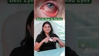 Best Eye Drops for Red Eyes | Redness Relief Eye Drops | #ytshort #youtube