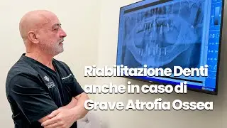 Denti fissi anche in casi estremi di grave l&rsquo;atrofia ossea