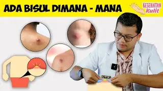 KUPAS TUNTAS BISUL ATAU FURUNKEL - DOKTER SADDAM ISMAIL