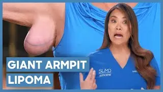 Dr. Lee Removes A GIANT Armpit Lipoma | Dr Pimple Popper | Love Medical