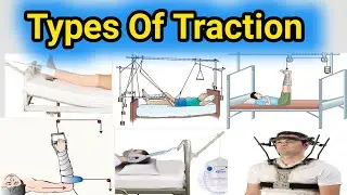 Types Of Traction / Traction Types / Orthopaedic Traction / skin and skeleton
