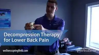 Springfield IL Chiropractor - Decompression Therapy for Lower Back Pain