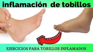 inflamación crónica de tobillo como quitarla
