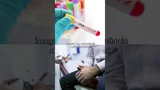 PSA sem p&acirc;nico: quando come&ccedil;ar e como interpretar com seguran&ccedil;a?