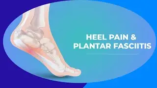 Causes of Plantar Fasciitis.|One Common Reason for Heel Pain &ndash; Anatomy You Didn&rsquo;t Know!&rdquo;#trending 