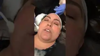 FACEBOOK LIVE: Facial vs Peels | The Centre PC Medical Rejuvenation Spa