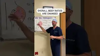 Are BBLs Permanent? | Butts By Design