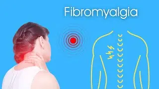 What is Fibromyalgia?