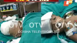 Know The Astonishing Details Of Separation Surgery Of Odisha Conjoined Twins