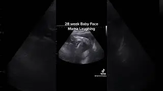 28 weeks 2D Ultrasound #jerbearimaging #ultrasound #baby #28weekspregnant