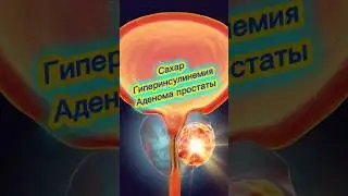 Гиперинсулинемия и развитие аденомы простаты #инсулинорезистентность #простата #сахар #ожирение #вес