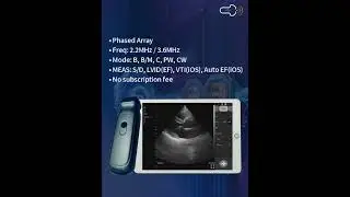 New Cardiac Handheld Ultrasound with CW