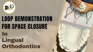 Loops Simplified: Step By Step Guide for Faster Space Closure in Lingual Orthodontics.