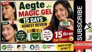 Aegte magic Gel 15 day review || Results after using it for 15 days || hydra magic Gel | #aegte
