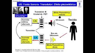 Aula Te&oacute;rica Eco-Doppler Vacular; Princ&iacute;pios F&iacute;sicos em Ultrassonografia