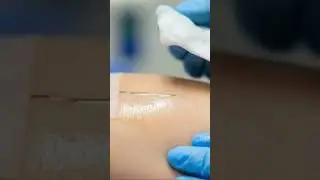 Iv insertion using sterile techniques.