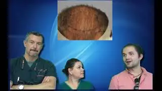 A younger guy's hair transplant journey continues with Dr. Lindsey | McLean | Virginia | Washington