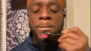 Every Slow and Average gainers on Minoxidil needs to Derma Roll