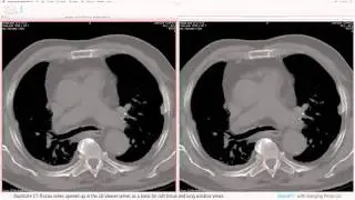 aycan workstation (former OsiriX PRO) with Advanced Hanging Protocols