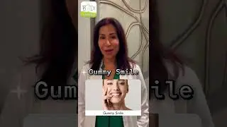 Do you really need Botox treatments at your age? 💉#Botox #dysport #skincare