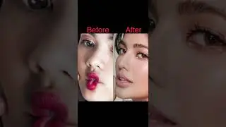 Jane De Leon before retoke plastic surgery 