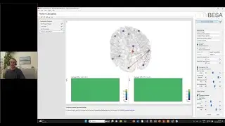 Webinar: Resting-state brain connectivity analysis with BESA Connectivity 2.0