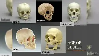 Skull Shape by Age