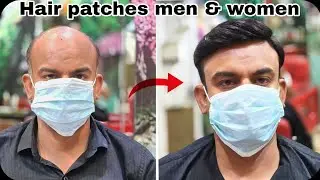 Clip system Hair patch service for men & women Shop in Agra mathura mo.7037489714, bhartpur dholpur 