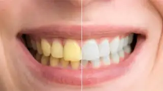 Photoshop Secrets for Dazzling White Teeth