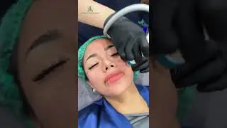 Meso Therapy - pilihan sempurna untuk para pecinta kecantikan