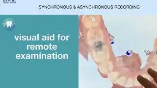 DP13 screening care homes by scanning with trained nurses supporting oral health champions