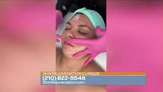 Skin Rejuvenation Clinic SA Live Interview NanoNeedling