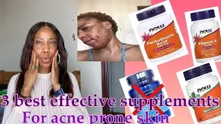 How to treat acne prone skin with 3 effective supplements for acne&rsquo;s #zincpicolinate#acne#Ruchi Ata