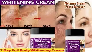 What cream is best for skin whitening? Latibule skin whitening cream review