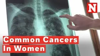 5 Most Common Cancers Affecting Women
