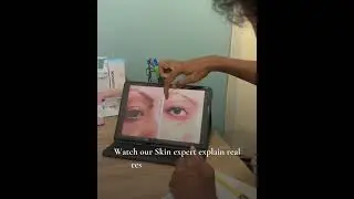 From Filters to Real Skin Transformations