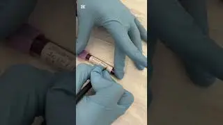 Phlebotomy project video