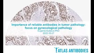 Webinar: Importance of reliable antibodies in tumor pathology, focus on gynecological pathology