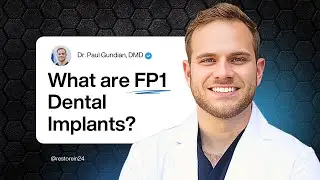 FP1 Dental Implants Cost Breakdown: Is the Gumless Bridge Worth It? | Restore in 24