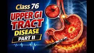 Class 76 Upper GI Disease Part II