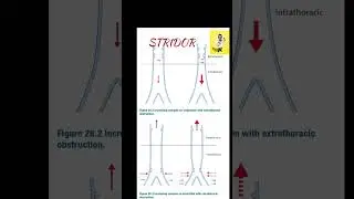 #stridor @theentingdoc #ent #shorts #youtubeshorts #jagathycomedyscenes #salimkumarcomedyscenes