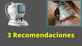 Refracción en Queratocono. 3 recomendaciones.(Parte I).