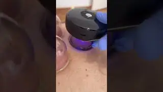 ACHEDAWAY CUPPER- HQ DEVICE #cupping #hijama