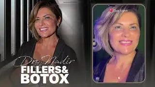 FILLER & BOTOX