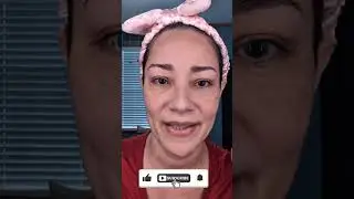 Melasma Day 48 Update Musely
