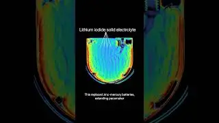 The CIA invented the battery in pacemakers | CT scans of a pacemaker